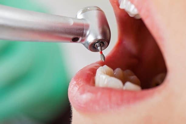 Best Weekend Emergency Dentist in Butler, PA